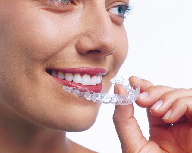 Invisalign - die nahezu unsichtbare Zahnspange