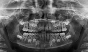 OPG mit Digitalem Röntgen in der Kieferorthopädie-Praxis Dr. Prein, Wiesloch